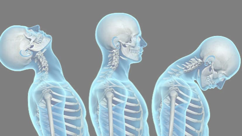 Beyond the Rear-End Collision: Biomechanics