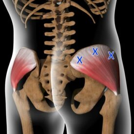 picture of pelvic trigger points